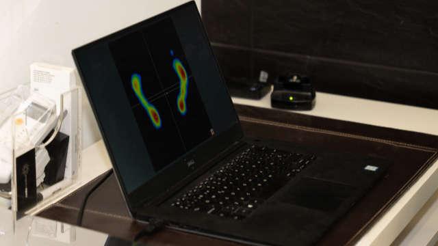 Registro de la huella plantar Estudio de la huella plantar con plataforma digital