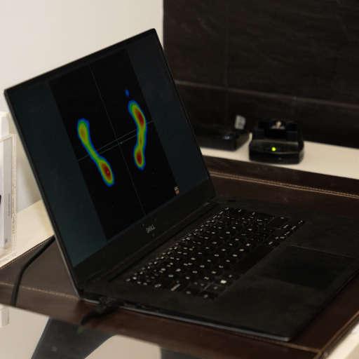 Diseño de ortosis plantar infantil en Barcelona